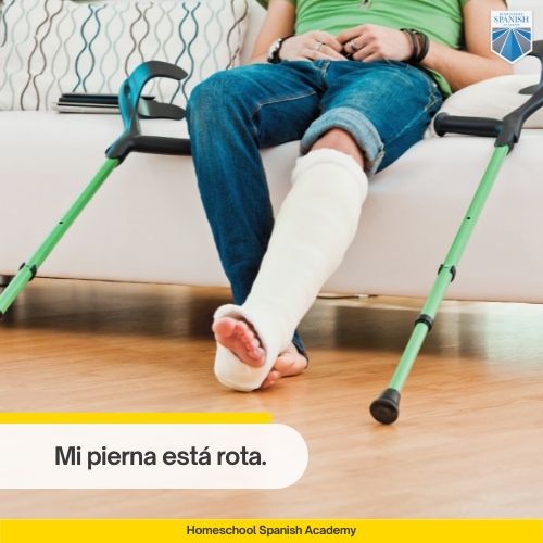 Mi pierna está rota.